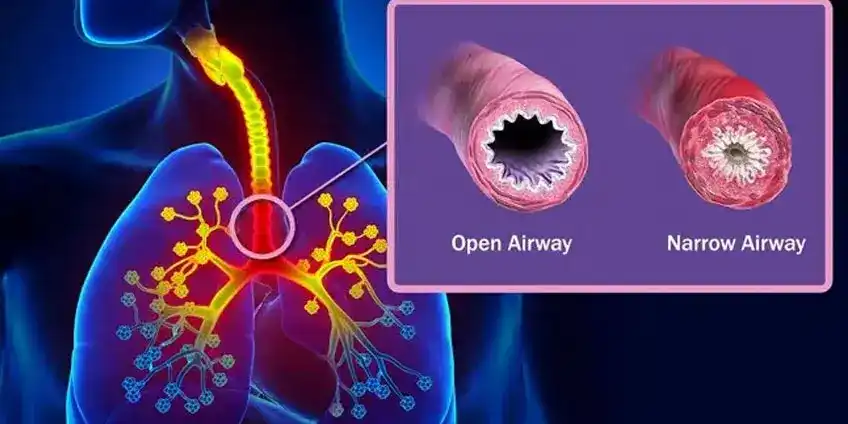 Biomagnetism_Asthma