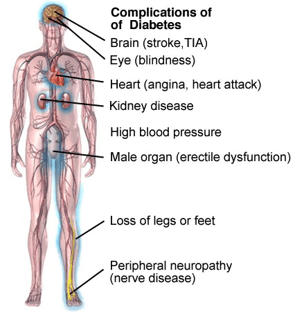 diabetes-and-biomagnetism